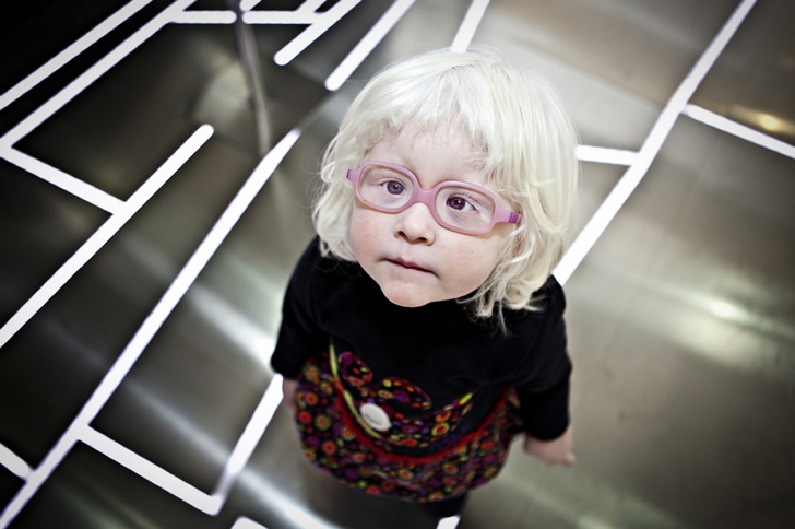 albino çocuk fotoğraf